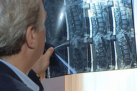 Arzt betrachtet Röntgenbild eines Bandscheibenvorfalls